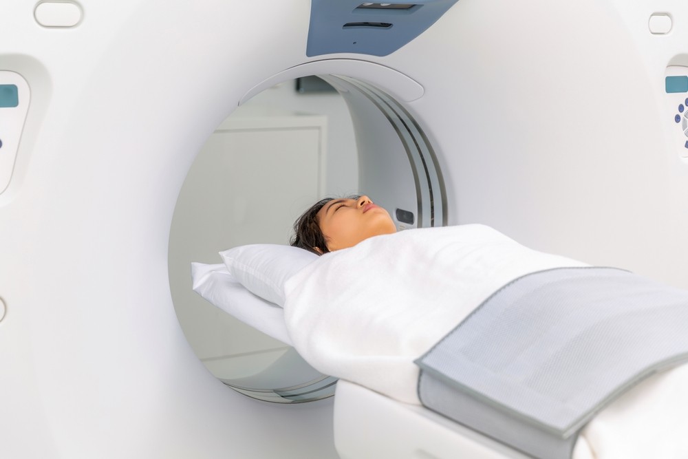 Should You Get Your Head Scanned After A Car Accident