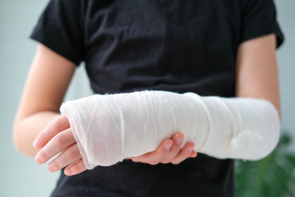 When a Severe Burn Injury Requires Long-Term Medical Treatment